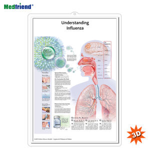 Tableau mural anatomique <span class=keywords><strong>humain</strong></span> médical 3D/Poster-Comprendre la <span class=keywords><strong>grippe</strong></span> - Product Image 1