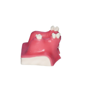 Modelo de Entrenamiento para Levantamiento de Seno Maxilar - Modelo de Práctica de Seno Maxilar Tipo C para Educación Dental - Product Image 4