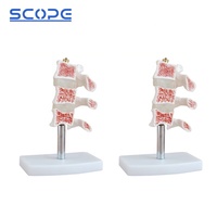 Instrumento de enseñanza de maniquí médico, simulador anatómico de esqueleto, modelo de osteoporosis humana de 3 vértebras, SC-A1022