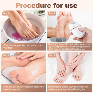 Wholesale Smart Home <b>Foot</b> <b>File</b> & Callus Remover Rechargeable Tool with 2 Speeds and 3 Interchangeable Grinding Heads - Product Image 3