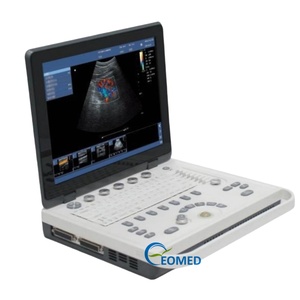 Échographe 2D PC à grand écran, design convivial, pour usage vétérinaire et humain, avec un grand angle de vue, image claire CU09 - Product Image 2