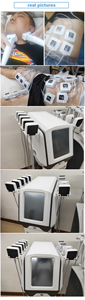 Appareil portable Trusculpt Flex à 10 poignées pour le remodelage corporel, le traitement de la cellulite, le rajeunissement et le raffermissement de la peau - Product Image 4