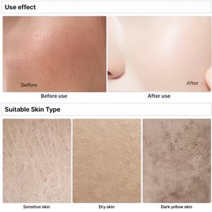 Mascarilla Blanqueadora de Ácido Kójico al por Mayor, Hidratante y Aclarante para la Decoloración, Aceite de Semilla de Uva, Cera de Abejas, Vitamina E, Piel Radiante y Suave - Product Image 4