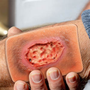 Modelo de Enseñanza de Heridas Necróticas DARHMMY - Simulación Realista de Necrosis Cutánea para Entrenamiento Quirúrgico y de Enfermería, Tipo Ciencias Médicas - Product Image 2