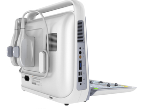 One-Stop Service Jinzhong JZ-CUP60 15-Inch Laptop 2d Volledig Digitale Ultrasone Scanner Digitale Kleur <span class=keywords><strong>Doppler</strong></span> Diagnostische Machine - Product Image 3