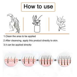 G Logo personnalisé Croissance rapide <span class=keywords><strong>des</strong></span> cheveux Soin réparateur du cuir chevelu Anti-chute <span class=keywords><strong>Repousse</strong></span> <span class=keywords><strong>des</strong></span> cheveux Sérum épais Essence pour hommes femmes - Product Image 4