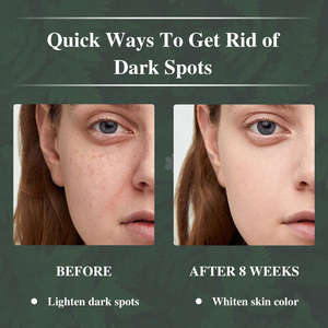 ครีมบำรุงผิวหน้าสูตรส่วนตัว <span class=keywords><strong>ชา</strong></span>เขียวธรรมชาติ วิตามินอีและซี ลดเลือนริ้วรอย ต่อต้านริ้วรอย ไนอะซินาไมด์ ลดจุดด่างดำ - Product Image 4