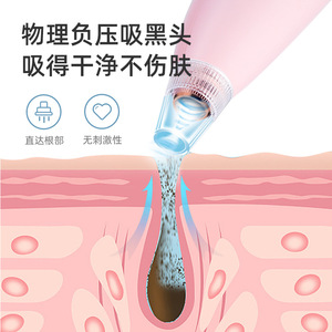 Xingbao Vacuum Blackhead Remover Electric Portable Nose Pore Cleaner Three Gears Premium Version - Product Image 1