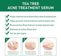 Las cicatrices secas del acné reducen la eliminación, el tratamiento antiacné más vendido, suero facial para la piel con ácido salicílico, extractos de aceite de árbol de té