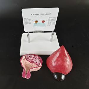 Comparación de Órganos Viscerales Normales con Corazón, Pulmón, Vejiga, Vasos, Tráquea Oral, Modelo Médico Fetal - Product Image 5