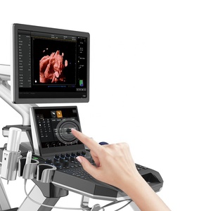 Ecógrafo Veterinario Dawei DW-T30 con Tecnología de Submatriz y Carro, Precio Económico en China, para Animales Pequeños - Product Image 4