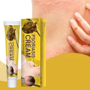Vente chaude psoriasis crème eczéma herbals traitement dermatite allergique sueur tache peau crème antiprurigineuse
