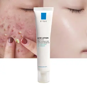 Crème visage pour l'élimination des cicatrices et des boutons d'acné avec le peroxyde de benzoyle LOGO personnalisé