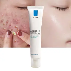 Biểu Tượng Tùy Chỉnh Benzoyl Peroxide Loại Bỏ Vết Sẹo Và Mụn Trứng Cá Mụn Mụn Mụn Vết Đốm Đen Remover Mặt Kem