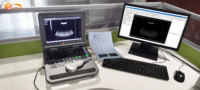 Système de diagnostic échographique numérique complet SUN-806A à bas prix, basé sur PC, noir et blanc, avec écran 12,1 pouces