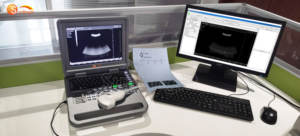 Untuk SUN-806A Sistem Diagnostik <span class=keywords><strong>Ultrasound</strong></span> Hitam Putih Berbasis PC Harga Terjangkau, Mesin <span class=keywords><strong>USG</strong></span> Digital Penuh dengan Layar 12.1 inci - Product Image 4