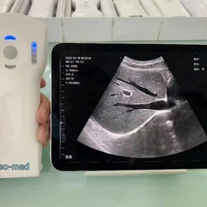 Échographe Doppler Couleur Portable Sans Fil Mini Wifi 192 Éléments DCU19H, Nouveauté Médicale - Product Image 5