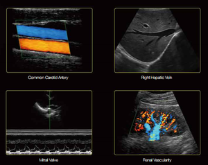 Edan Veterinary Ultrasound U60 Vet <span class=keywords><strong>Precio</strong></span> de fábrica Nuevo portátil Speckle Reducción de imágenes Ultrasonido veterinario - Product Image 6