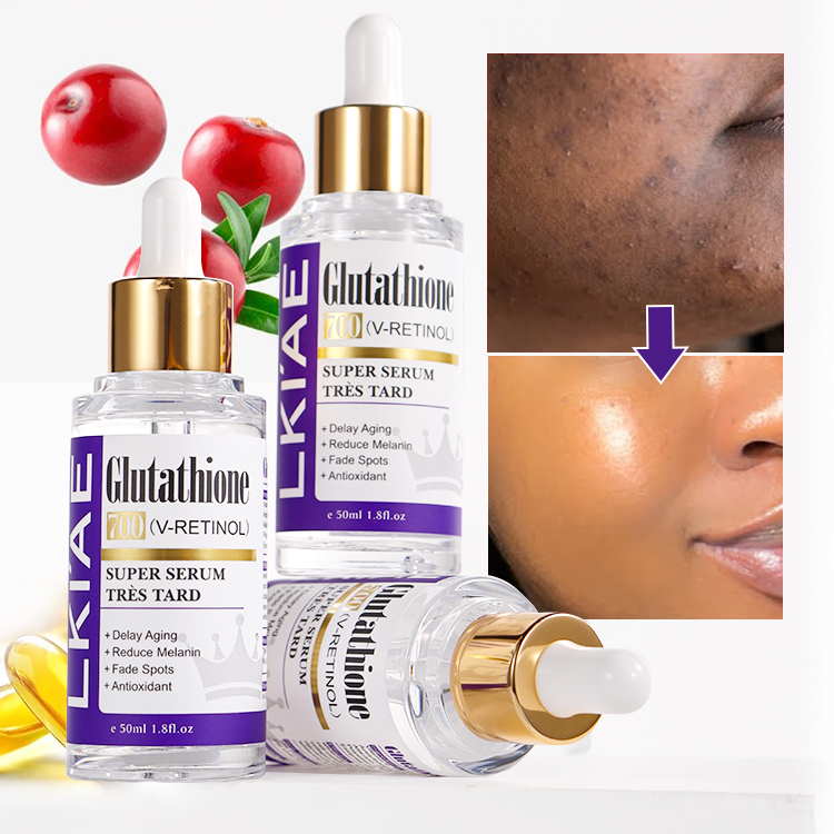 nebulized glutathione for mold Private Label Glutathione Vitamin C Kojic Acid Hyaluronic Acid Reduce  Melanin Skin Whitening Facial Serum for Dark Spots Remover| Alibaba.com