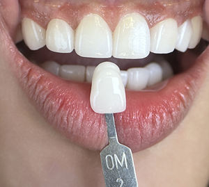 La migliore vendita CAD CAM dentale CNC <span class=keywords><strong>5</strong></span> assi umido e secco fresa dentale per blocchi di Zirconia titanio - Product Image 5