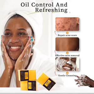 2025 nueva llegada 24K oro aminoácidos jabón hecho a mano blanqueamiento limpieza profunda aceite esencial jabón 200g para piel negra - Product Image 2