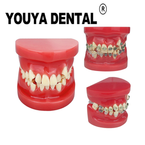Modelo de Maloclusión Dental para Prácticas de Estudiantes de Odontología, Enseñanza, Entrenamiento, Comunicación, Equipo Médico Bucal - Product Image 1