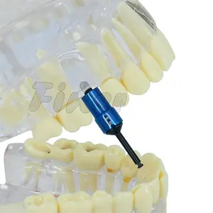 Fresa dental de osseodensification Taladros de extensión del hueso con los tapones