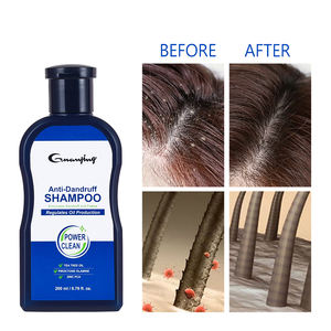 <span class=keywords><strong>Shampoing</strong></span> Anti-Pelliculaire à l'Huile d'Arbre à Thé, Apaise le <span class=keywords><strong>Cuir</strong></span> <span class=keywords><strong>Chevelu</strong></span> <span class=keywords><strong>Irrité</strong></span> et les <span class=keywords><strong>Démangeaisons</strong></span>, Fortifie et Nourrit les Cheveux - Product Image 6