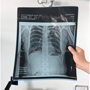 جهاز أشعة سينية محمول K-DX70 للطب البيطري، معدات أشعة سينية رقمية بسعر تنافسي للمستشفيات - Product Image 5