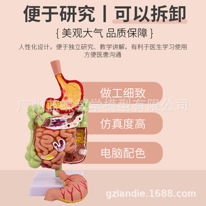 Modelo patológico del colon humano, modelo anatómico gastrointestinal, modelo patológico de colon, cecum, recto y duodeno - Product Image 5