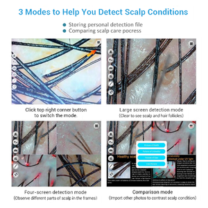 Varita de alta frecuencia 5 en 1 para el crecimiento del cabello, masaje de cabeza, HD folículos pilosos, escáner de análisis del cuero cabelludo, máquina analizadora de cabello - Product Image 4