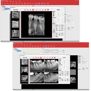 جهاز استشعار احترافي لأشعة الأسنان سهل الاستخدام ، جهاز استشعار عالي الدقة بالأشعة السينية 500B Hdr Rgv - Product Image 3