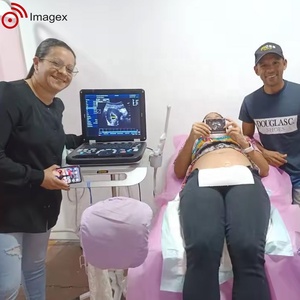 Peralatan sonografi medis sistem Ultrasound kompak dengan probe Array Linear, cembung, dan sewa - Product Image 6
