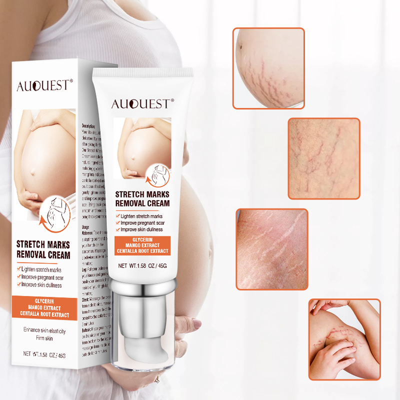 Maternity Stretch Marks Removal Cream Body