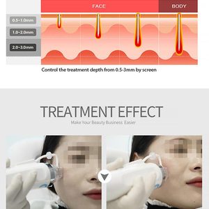 Chuyên nghiệp đa chức năng Tattoo <span class=keywords><strong>Machine</strong></span> với 980nm Diode laser cho hút mỡ mạch máu loại bỏ trên khuôn mặt và cơ thể da - Product Image 4