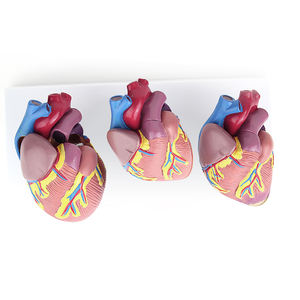 Model penyakit jantung medis 3 buah, Model anatomi jantung manusia ukuran alami, organ Sains jantung pendidikan - Product Image 6