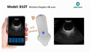Sonda Doppler USB Wifi para Oftalmología, Recién Nacidos, Mascotas, Ultrasonido Ocular 8Mhz 11Mhz Microconvexo de Palma, Color, Reutilizable, CF PW PDI - Product Image 2