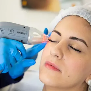 ตลับ RF <span class=keywords><strong>Vivace</strong></span> RF Fractional - Product Image 5