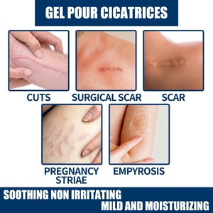 Meilleures ventes, crème hydratante nourrissante en profondeur, gel chirurgical réparateur de cicatrices pour la peau tendre pour les soins du corps - Product Image 3