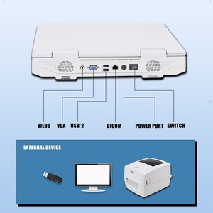 Sistema de Ultrasonido <span class=keywords><strong>Doppler</strong></span> Color Portátil RS N20 para Imágenes Cardíacas y Ecocardiografía - Product Image 4