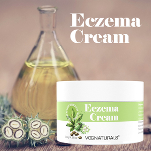 Crema de eccema de etiqueta privada OEM y ODM, crema corporal hidratante para el cuidado de la piel para la piel seca que pica - Product Image 3