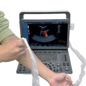 SYA-S90_vet veterinaria 15.6 pollici ad alta risoluzione a colori Doppler a ultrasuoni dispositivo diagnostico ecocardiografico macchina per animali domestici - Product Image 5