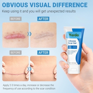 <span class=keywords><strong>Gel</strong></span> de <span class=keywords><strong>cicatrice</strong></span> en <span class=keywords><strong>silicone</strong></span> de qualité médicale de marque privée 100% élimine les démangeaisons de la plaie C-section chirurgicale nouvelles vieilles cicatrices <span class=keywords><strong>Gel</strong></span> <span class=keywords><strong>cicatrice</strong></span> loin de la crème - Product Image 3