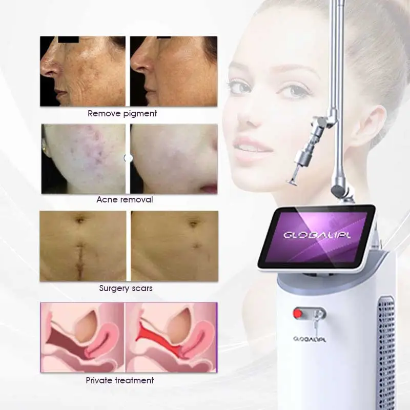 Medical grade lattice vaginal tightening co2 fractional vaginal tightening skin care beauty equipment machine