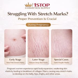 Huile de massage corporel à l'argan vendue exclusivement en gros, <span class=keywords><strong>anti</strong></span>-<span class=keywords><strong>cellulite</strong></span>, soin éclatant de la peau, ingrédients cosmétiques à l'arbre à thé, à la rose et au romarin - Product Image 2