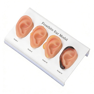 Maniquí DARHMMY para Demostrar las Etapas Progresivas de Congelación de las Orejas, de Leve a Severa, para Enseñanza Médica - Product Image 2
