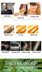 100% Tất Cả Các Tự Nhiên Thảo Dược Handmade Tóc Xà Phòng Hữu Cơ Vegan Rắn Tóc Dầu Gội Thanh Xà Phòng - Product Image 5