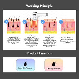 Máquina de Depilación Láser de Diodo UNTlaser 755 808 1064, Depilación Permanente, 1200w 1500w 2000w - Product Image 2