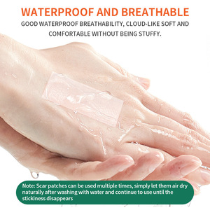 BCK Silicone Scar Patch 4cm <b>Roll</b> Soften Flatten Scars For Old New Scars - Product Image 5