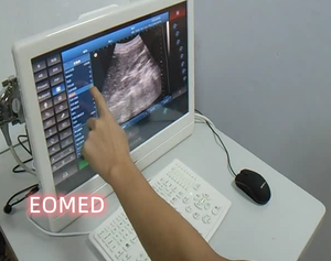 Máy Quét Siêu Âm Động Vật B/W Giá Rẻ Bán Chạy Nhất Máy Dò Siêu Âm Thú Y Cầm Tay Màn Hình Cảm Ứng BW08vet - Product Image 3